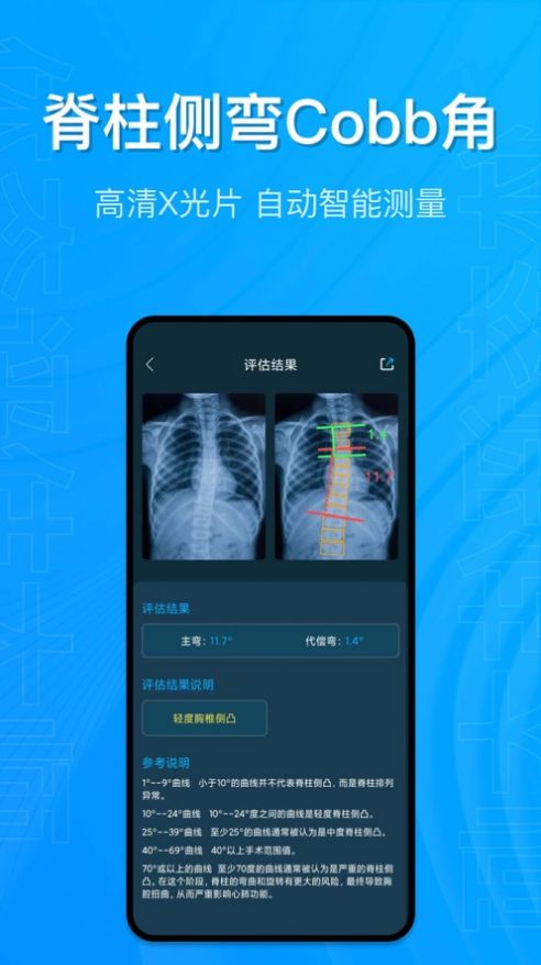 体态评估大师精简版